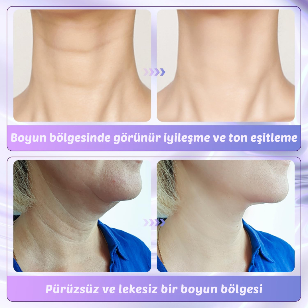 Glorence® Sıkılaştırıcı Kolajen